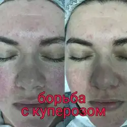 Ольга Селятенко косметолог