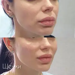 Катерина Бену