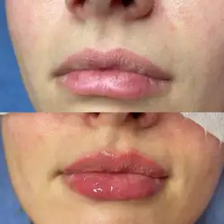 Катерина Якимович