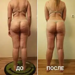 Дмитро Щербак — Київ