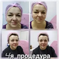 Неллі — Дніпро
