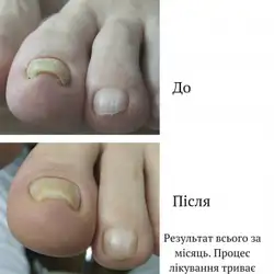 Тетяна Дядинчук-Скрипка