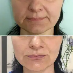 Наталiя Наталiя