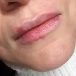 Галина Іллющенко Косметолог