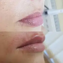 Коренькова Катерина