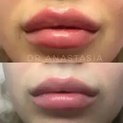 Анастасія Κоновалова
