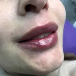 Анна Самойлович