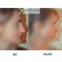 Медичний центр Ліко-Мед - Миколи Ушакова