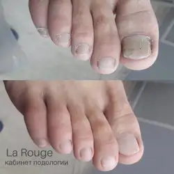La Rouge