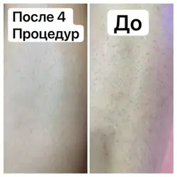 Dr Angelika
