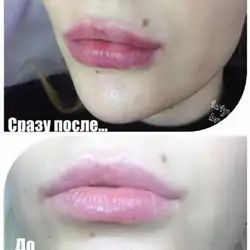Тетяна Браїло