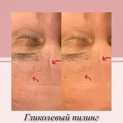 Поліна Олійник