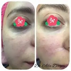 Алла