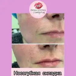 Інна Левіна - косметолог