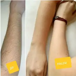 Шугаринг