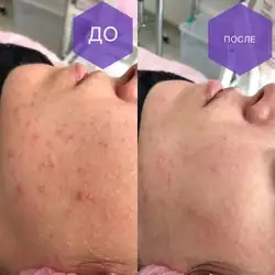 Дар'я Калініна майстер депіляції