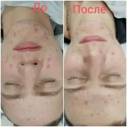 Ірина Столеру