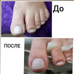 Коритна Анастасія