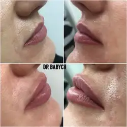 Тетяна Бабич майстер епіляції