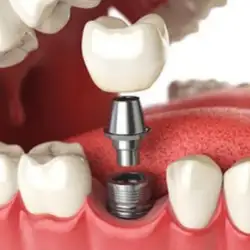 Dental Concept