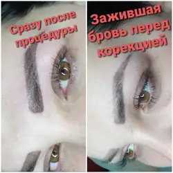 Вікторія Котвицька майстер депіляції