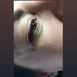 Альона Капуста косметолог