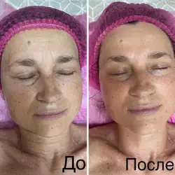 Людмила Сузима