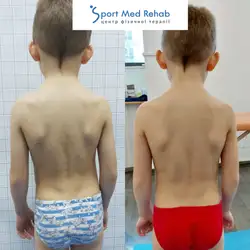 Sport Med Rehab