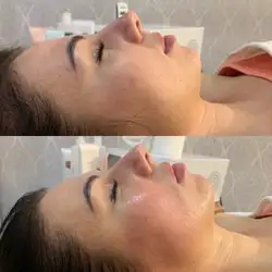 Альона Подільчик — Одесса