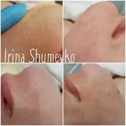 Ірина Шумейко