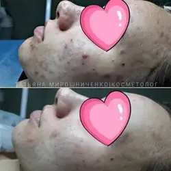 Тетяна Мирошниченко
