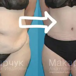 Анатолій Макарчук