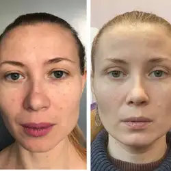 Алла Рогожа