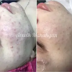 Манукян Аревік