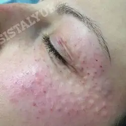 Катерина Сісталюк