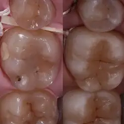 Dental