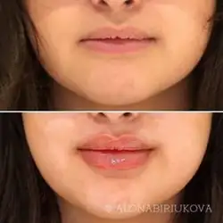 Альона Бірюкова