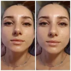 Анна Ковальчук
