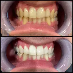 Студія Smile Bar - Стрий