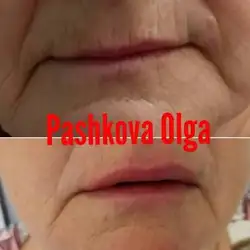 Ольга Пашкова — Херсон