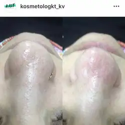 Катерина Ковбаса — Київ