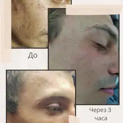 Аліна Безкровна