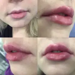 Іляна Волкова