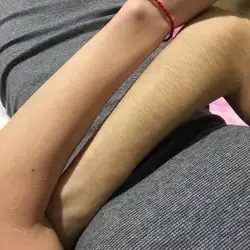 Шугаринг