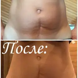 Світлана Херсун — Херсон