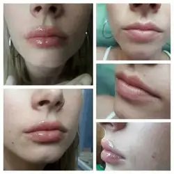 Валентина Колесниченко
