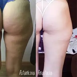 Анастасія Астанкова косметолог