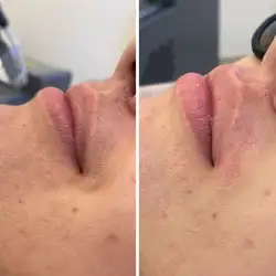 LaserMed — Кропивницький