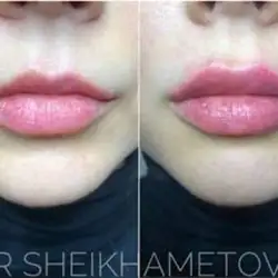 Елмаз Шейхаметова