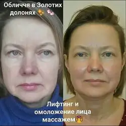 Zoloti Doloni — Київ